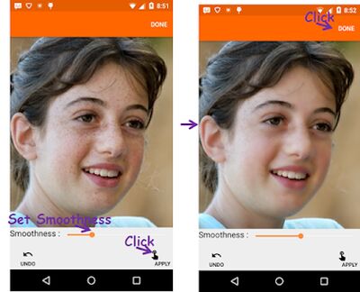 Download Face Acne Remover Photo Editor App (Free Ad MOD) for Android