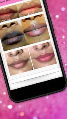 Download Lips Care (Unlocked MOD) for Android
