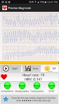 Download Cardiac diagnosis (arrhythmia) (Premium MOD) for Android