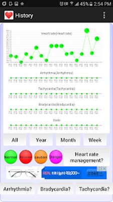 Download Cardiac diagnosis (arrhythmia) (Premium MOD) for Android