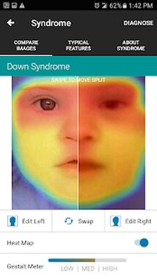 Download Face2Gene (Premium MOD) for Android