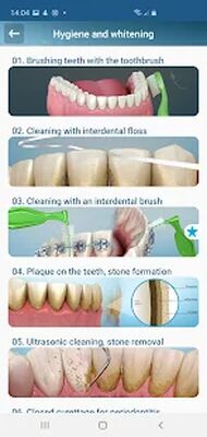 Download Dental 3D Illustrations for patient education (Free Ad MOD) for Android