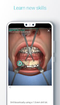 Download Touch Surgery: Surgical Videos (Free Ad MOD) for Android