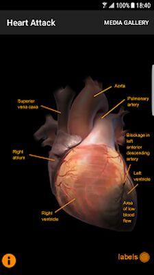 Download CardioSmart Heart Explorer (Pro Version MOD) for Android