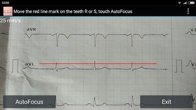 Download ECG Reader free (Free Ad MOD) for Android