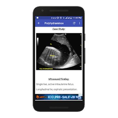 Download Obstetrics & Gyenacology Ultrasound Guide (Premium MOD) for Android