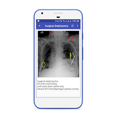 Download X-Ray Interpretation Guide (Free Ad MOD) for Android
